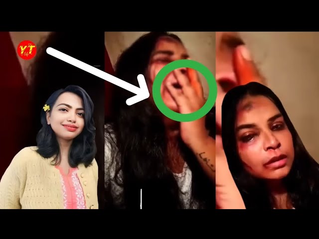 Moumita Original YouTube Viral Video Link , Dr Moumita Debnath Viral Video News