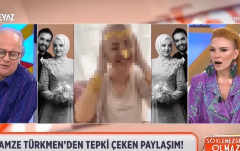 Viral Video gamze ezildi açık hali kadir ezildi kadir ezildi gamze açık hali gamze türkmen videosu beyaz tv gamze türkmen açık